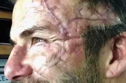 Cicatriz de David Beckham para filmación de King Arthur Movie