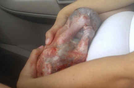 El milagroso parto de un bebé prematuro en un coche envuelto en el saco amniótico 