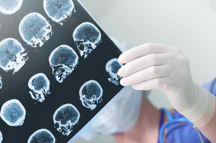 Profesional médica observando imágenes del cerebro
