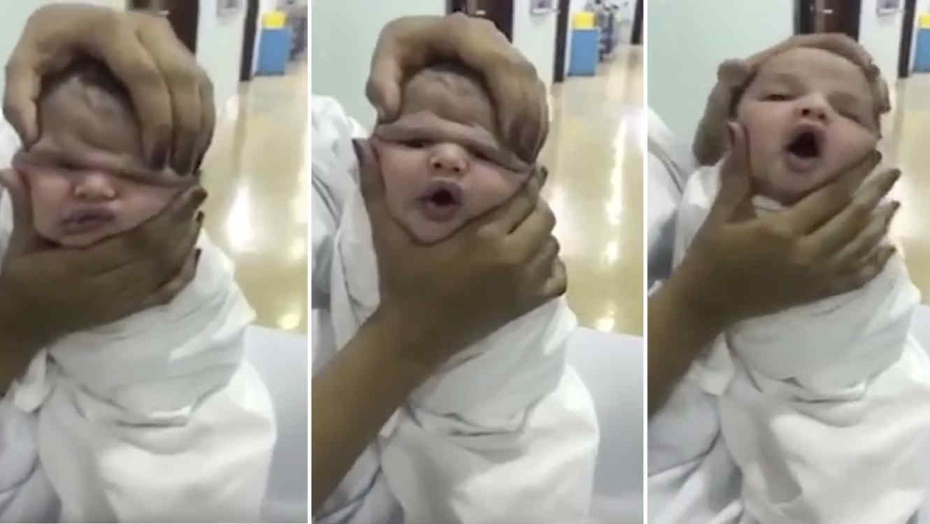 Enfermeras de un hospital juegan a deformar la cara de los 
