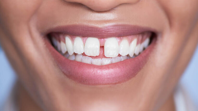 Los dientes y las encías podrían advertirte a tiempo si estás enfermo.