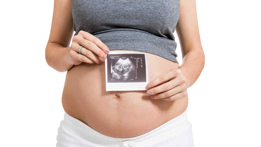 Mujer embarazada muestra foto de su ecografía