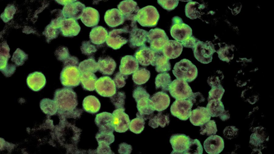 Una imagen del parásito Naegleria fowleri bajo el microscopio, provista por los Centros para el Control y la Prevención de Enfermedades (CDC).