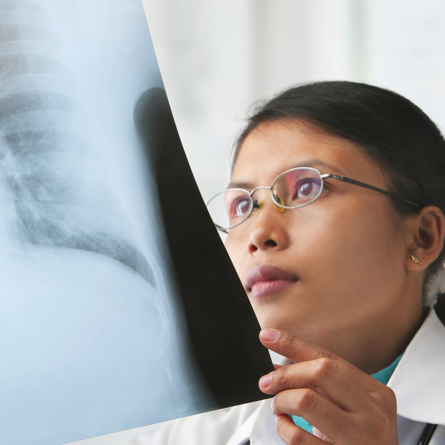 Médica revisa radiografía de pulmones