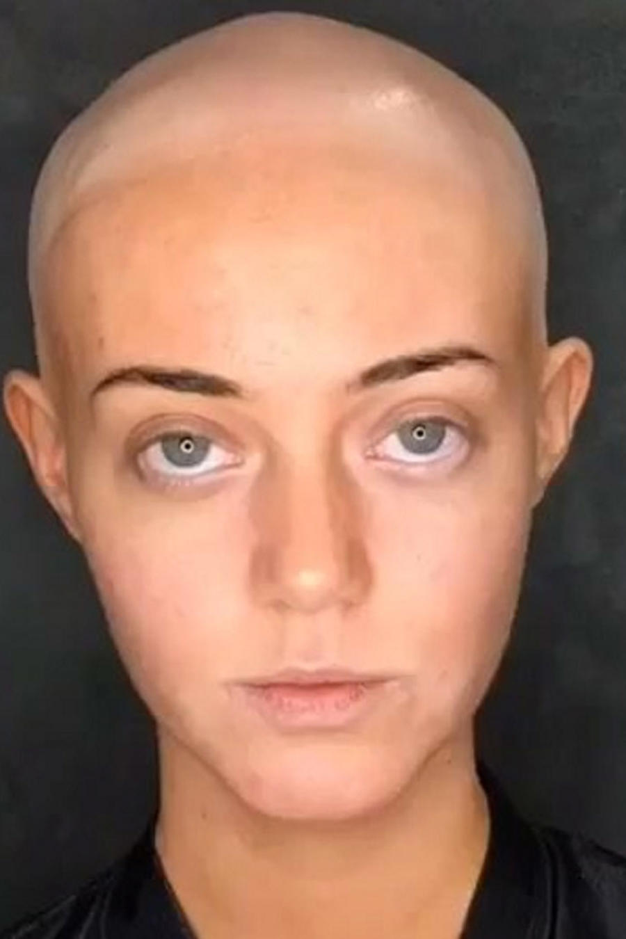 Modelo Lara Kitchen revela que padece de alopecia