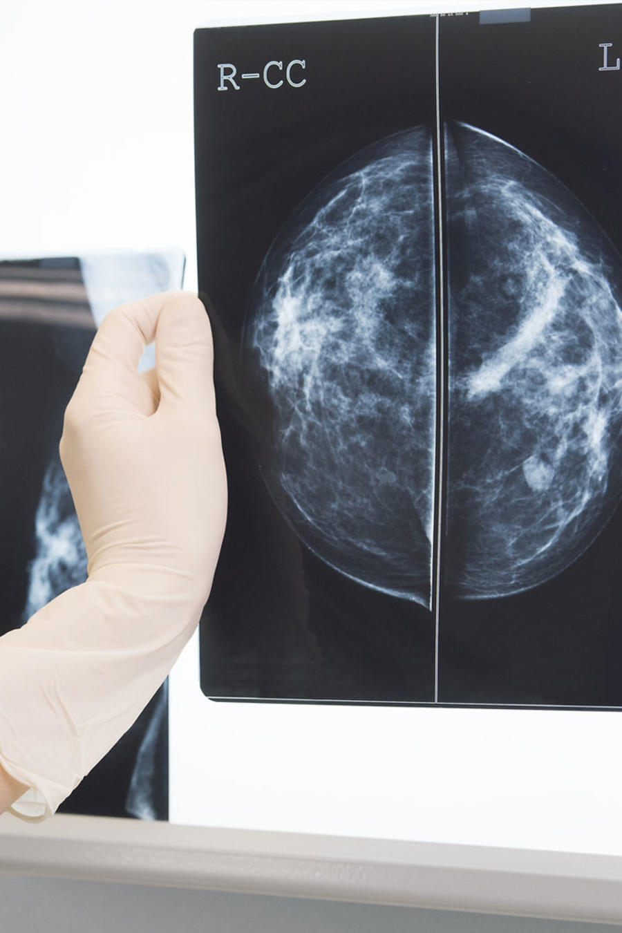 Médica mirando mamografía