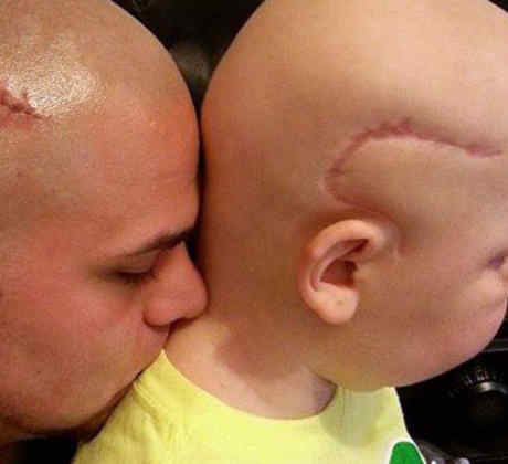 Josh Marshall se tatúa la cicatriz de su hijo enfermo de cáncer para ayudarle con su autoestima