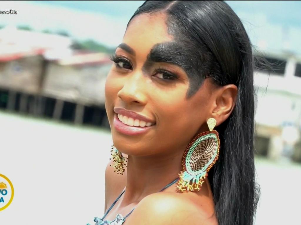 Modelo con lunar negro en la cara revoluciona los estándares de belleza en  Miss Colombia